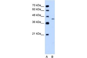 Image no. 1 for anti-Dihydroorotate Dehydrogenase (DHODH) (C-Term) antibody (ABIN2777080)