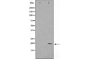Image no. 1 for anti-RNA Polymerase II TBP-Associated Factor Subunit G (TAF9) (Internal Region) antibody (ABIN6262731)