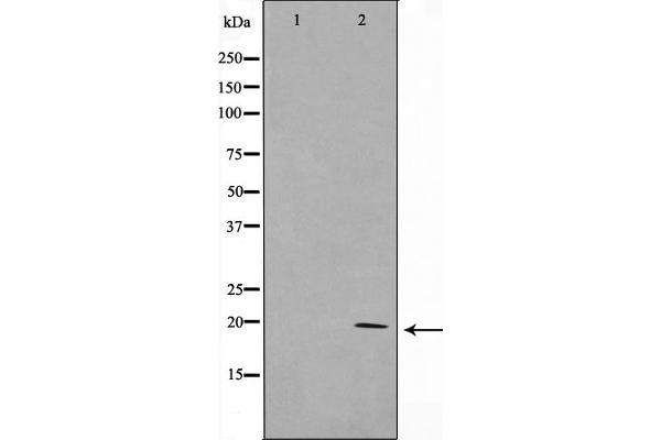TAF9 antibody  (Internal Region)