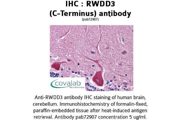 anti-RWD Domain Containing 3 (RWDD3) (C-Term) antibody