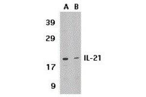 Image no. 1 for anti-Interleukin 21 (IL21) (Center) antibody (ABIN2474977)