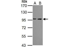 Image no. 2 for anti-Proteasome (Prosome, Macropain) 26S Subunit, Non-ATPase, 2 (PSMD2) (Center) antibody (ABIN2855347)
