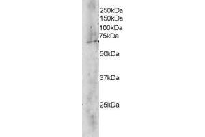 anti-Transducin (Beta)-Like 1X-Linked (TBL1X) (C-Term) antibody