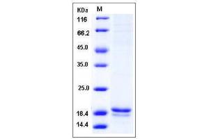 Image no. 1 for Arachidonate 5-Lipoxygenase-Activating Protein (ALOX5AP) (AA 1-161), (full length) protein (His tag) (ABIN2215147)
