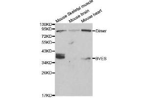 Western blot analysis of extracts of various cell lines, using BVES antibody.