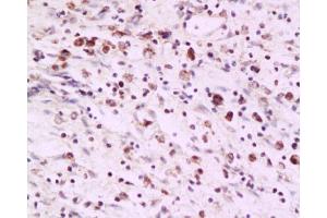 Image no. 5 for anti-PCNA Clamp Associated Factor (PAF) antibody (ABIN737931)
