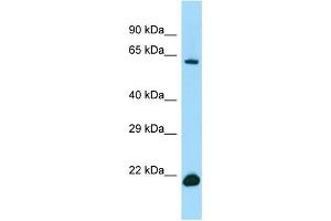 Image no. 1 for anti-Interferon Regulatory Factor 2 Binding Protein 2 (IRF2BP2) (C-Term) antibody (ABIN2790477)