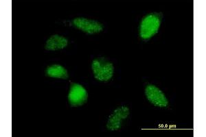 Immunofluorescence of purified MaxPab antibody to POLR3F on HeLa cell.