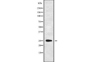Image no. 2 for anti-Complement Component 1, Q Subcomponent-Like 4 (C1QL4) (Internal Region) antibody (ABIN6260366)