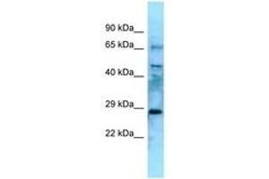 Image no. 1 for anti-Eyes Absent Homolog 4 (EYA4) (N-Term) antibody (ABIN6748312)