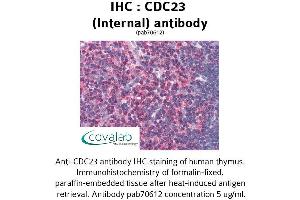 Image no. 2 for anti-Cell Division Cycle 23 (CDC23) (Internal Region) antibody (ABIN1732899)
