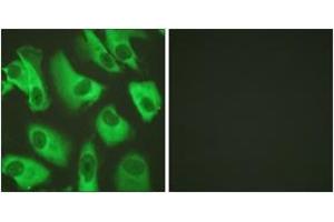 Image no. 3 for anti-Potassium Inwardly-Rectifying Channel, Subfamily J, Member 16 (KCNJ16) (AA 369-418) antibody (ABIN1532704)