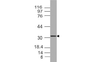 Image no. 1 for anti-Orthodenticle Homeobox 2 (OTX2) (AA 1-204) antibody (ABIN5027412)