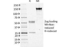 Image no. 1 for anti-Forkhead Box A1 (FOXA1) (AA 372-472) antibody (ABIN6939654)