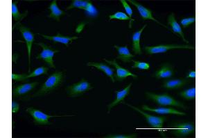 Immunofluorescence of monoclonal antibody to ABCG1 on HeLa cell.