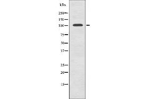 Western blot analysis of extracts from HepG2 cells using TF3C2 antibody.