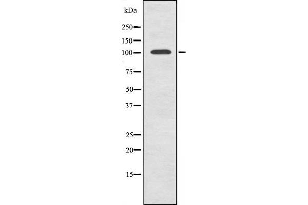GTF3C2 antibody  (N-Term)