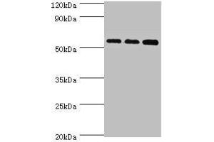 ACSM3 Antikörper  (AA 387-586)