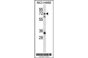 Image no. 1 for anti-ST6 (Alpha-N-Acetyl-Neuraminyl-2,3-beta-Galactosyl-1,3)-N-Acetylgalactosaminide alpha-2,6-Sialyltransferase 1 (ST6GALNAC1) (AA 28-57), (N-Term) antibody (ABIN656332)