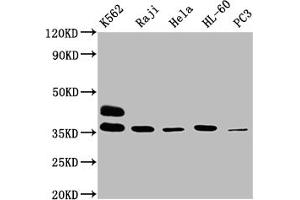 Western Blot Positive WB detected in: K562 whole cell lysate, Raji whole cell lysate, Hela whole cell lysate, HL60 whole cell lysate, PC-3 whole cell lysate All lanes: FCGR2A antibody at 1:2000 Secondary Goat polyclonal to rabbit IgG at 1/50000 dilution Predicted band size: 36, 35 kDa Observed band size: 36 kDa