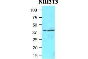 Image no. 2 for anti-N-Acetyltransferase 6 (GCN5-Related) (NAT6) (AA 1-308) antibody (ABIN933760)
