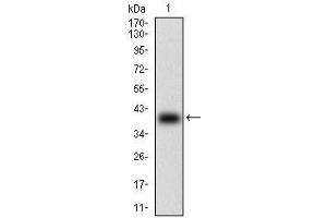 Image no. 1 for anti-T-Cell Leukemia/lymphoma 1A (TCL1A) (AA 10-104) antibody (ABIN5905507)
