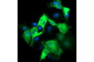 Image no. 2 for anti-Fetal and Adult Testis Expressed 1 (FATE1) antibody (ABIN1498225)