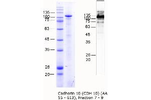 Image no. 2 for Cadherin 10, Type 2 (T2-Cadherin) (CDH10) (AA 55-613) protein (MBP tag) (ABIN3090333)