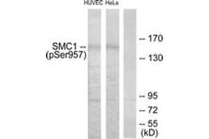 Image no. 1 for anti-Structural Maintenance of Chromosomes 1A (SMC1A) (AA 931-980), (pSer957) antibody (ABIN1531969)