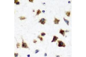 Image no. 1 for anti-ELAV-Like 3 (ELAVL3) antibody (ABIN6005272)