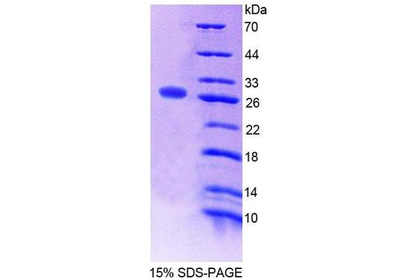 ATR Protein (AA 25-214) (T7 tag,His tag)