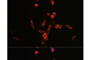Immunofluorescence analysis of NIH/3T3 cells using PIK3CA Polyclonal Antibody at dilution of 1:100.