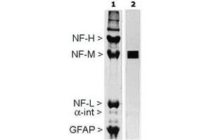 Image no. 1 for anti-Neurofilament Triplet M Protein (NEFM) antibody (ABIN534034)