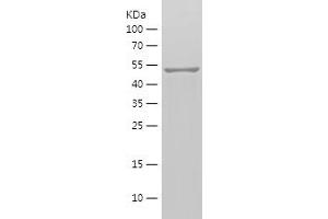 MMP2 Protein (AA 424-660) (His-IF2DI Tag)