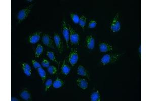 Image no. 3 for anti-ClpX Caseinolytic Peptidase X (CLPX) antibody (ABIN5647975)