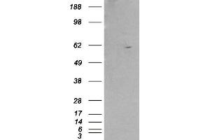 Image no. 1 for anti-Retinoid X Receptor, beta (RXRB) (Internal Region) antibody (ABIN185296)