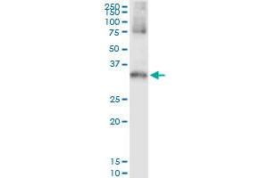 Image no. 2 for anti-serine/threonine Kinase 16 (STK16) (AA 1-305) antibody (ABIN522054)