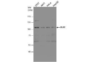 Image no. 5 for anti-Unc-51 Like Kinase 2 (ULK2) (C-Term) antibody (ABIN2856810)