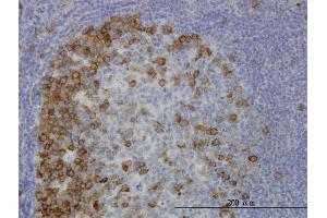 Image no. 1 for anti-Transforming, Acidic Coiled-Coil Containing Protein 3 (TACC3) (AA 1-100) antibody (ABIN564557)