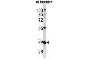 Image no. 1 for anti-Chromosome 10 Open Reading Frame 184 (C1ORF184) (AA 13-42), (N-Term) antibody (ABIN953398)