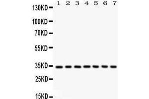 Image no. 1 for anti-Cyclin-Dependent Kinase 2 (CDK2) (AA 81-298) antibody (ABIN3043472)