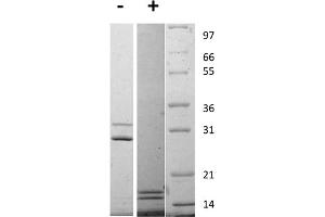 Image no. 1 for Interleukin-17 A/F Heterodimer (IL-17A/F) protein (ABIN6700950)