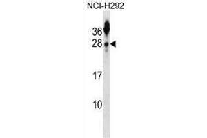 Image no. 1 for anti-Tetraspanin 2 (TSPAN2) (AA 24-54), (N-Term) antibody (ABIN955160)