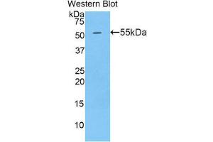 Image no. 1 for anti-Golgi Membrane Protein 1 (GOLM1) (AA 133-379) antibody (ABIN1859050)