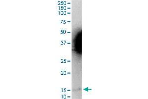 Image no. 2 for anti-Microsomal Glutathione S-Transferase 2 (MGST2) (AA 1-147) antibody (ABIN517923)