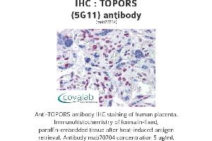 Image no. 1 for anti-Topoisomerase I Binding, arginine/serine-Rich, E3 Ubiquitin Protein Ligase (TOPORS) (AA 98-206) antibody (ABIN1723561)