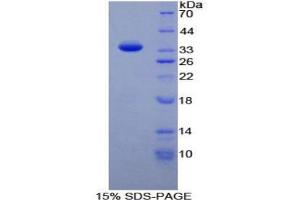 Image no. 1 for TAF1 RNA Polymerase II, TATA Box Binding Protein (TBP)-Associated Factor (TAF1) protein (ABIN3011805)