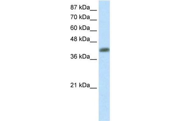 anti-Aprataxin (APTX) (C-Term) antibody