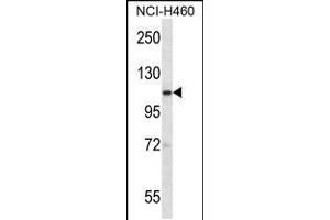 Image no. 2 for anti-SCY1-Like 2 (SCYL2) (AA 585-613) antibody (ABIN5537498)