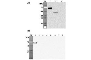 Image no. 2 for anti-delta-Like 1 Homolog (Drosophila) (DLK1) (Extracellular Domain) antibody (ABIN1169184)